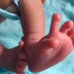 Indiababybornwith26fingersandtoes3300x248 1 Beesreign Media