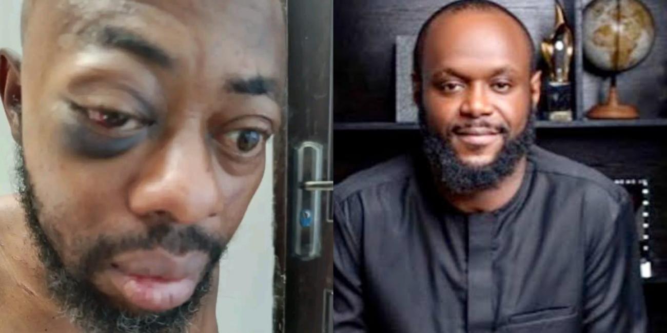 NANS President Beesreign Media